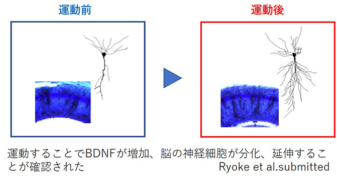 運動前と後のBDNF